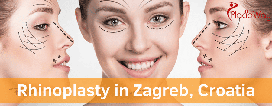 Rhinoplasty in Zagreb, Croatia